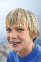 parents guide to braces sm